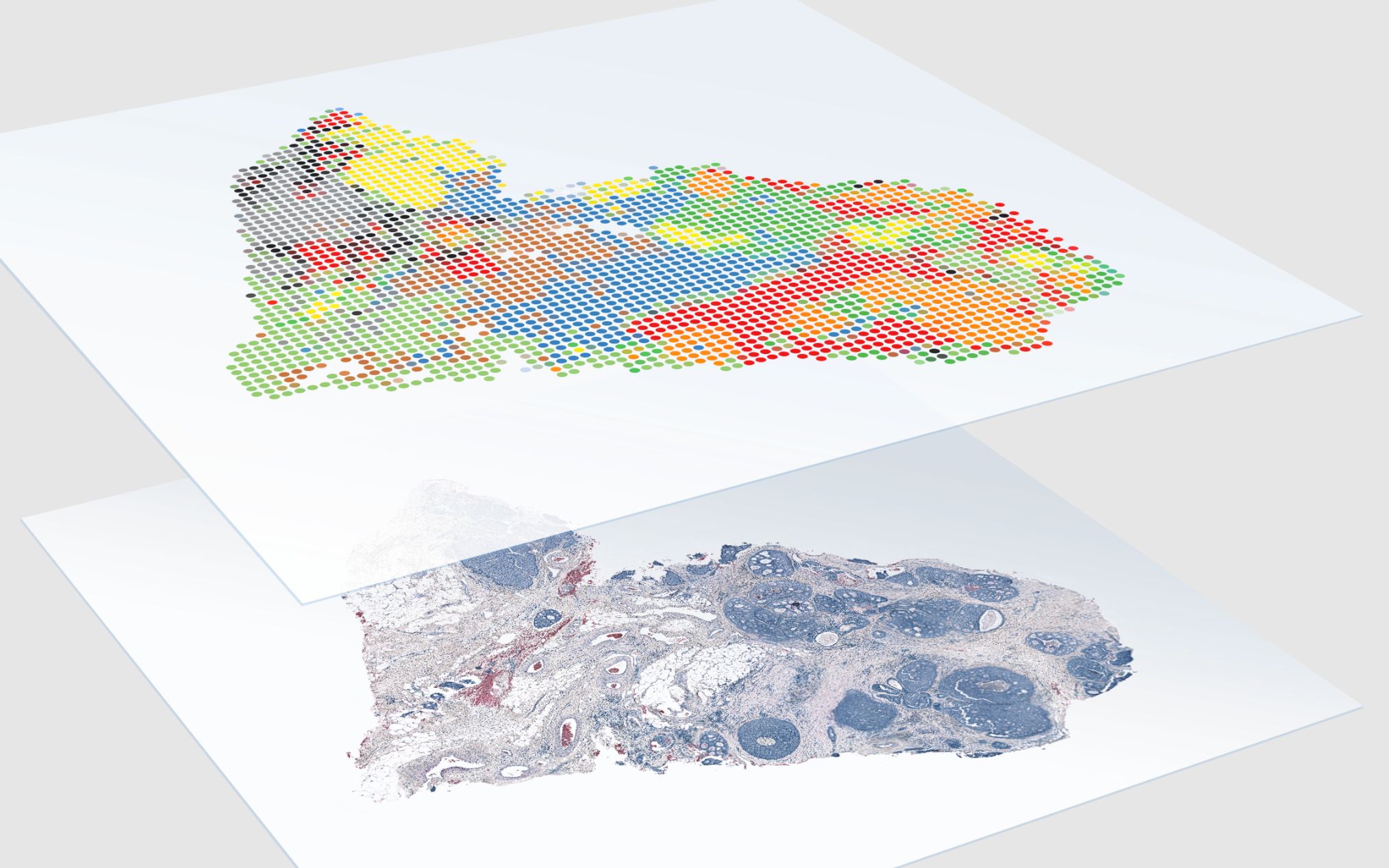 空间转录组(spatial transcriptome)数据分析基础教程哔哩哔哩bilibili