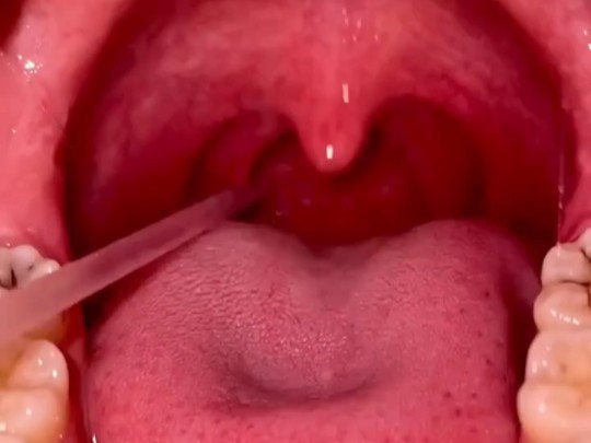 小姐姐口腔内部自检实拍