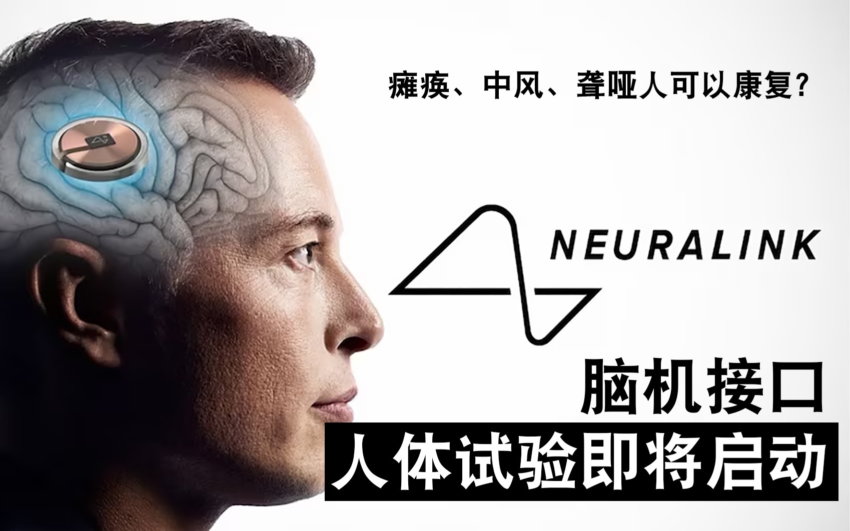 瘫痪,中风,聋哑人或可康复?马斯克脑机接口人体试验获得fda批准