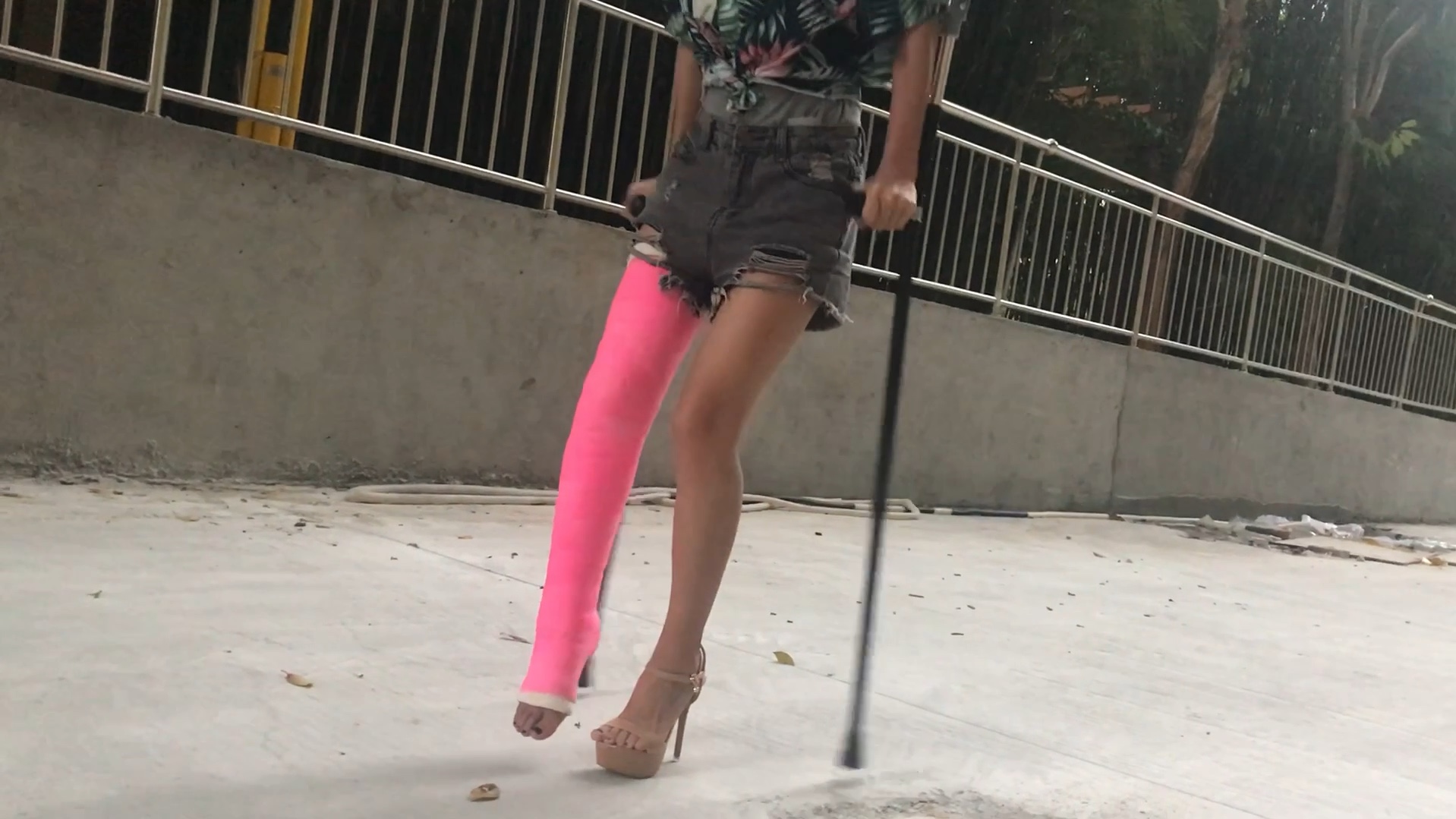 高跟鞋长腿石膏拄拐出行