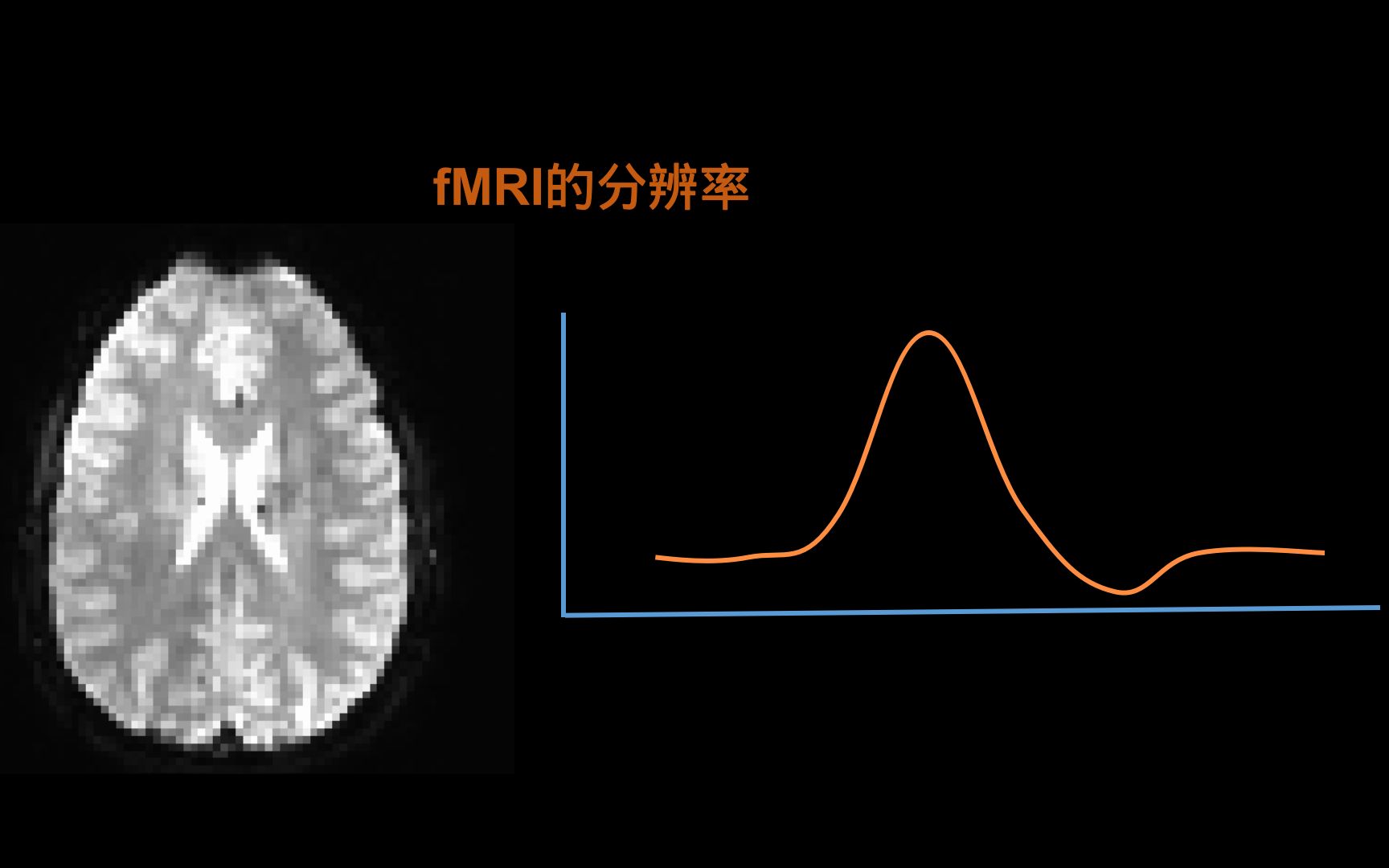 fMRI小知识:关于功能像的时间分辨率和空间分辨率的问题哔哩哔哩bilibili