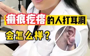 Download Video: 瘢痕疙瘩的人打耳洞会怎么样？瘢痕疙瘩该怎么治疗？