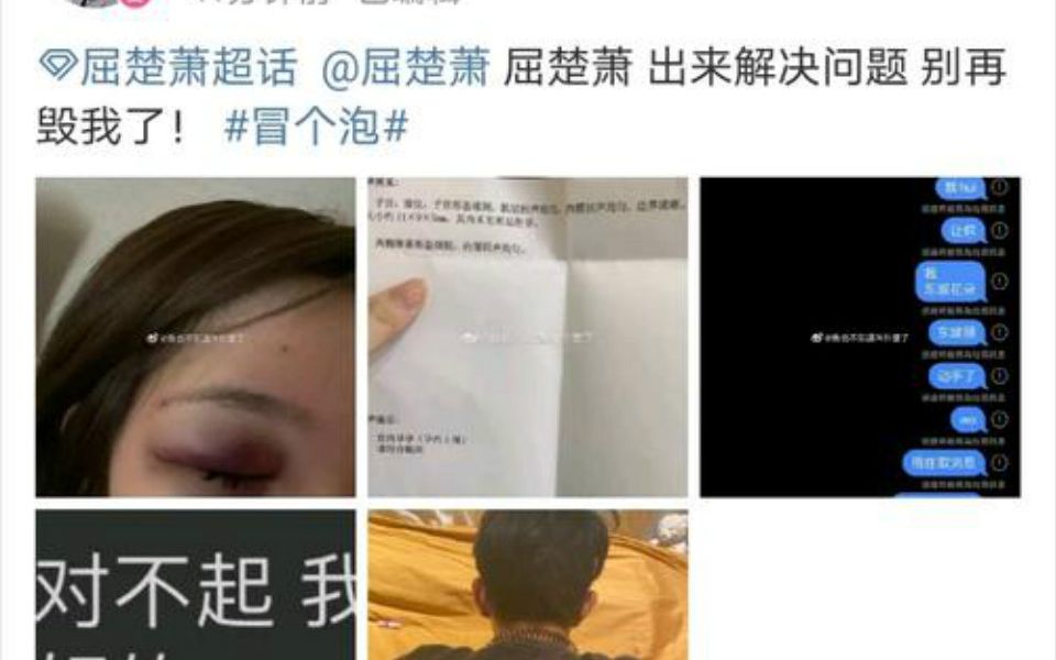 屈楚萧疑似再次家暴,女友堕胎后遭男方抛弃,抑郁成疾欲轻生【疑似屈楚萧女友晒瘀伤照 自曝遭殴打导致流产】随后删博解释:是他朋友打的哔哩哔哩...