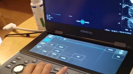 迈瑞便携超声M系列哔哩哔哩bilibili
