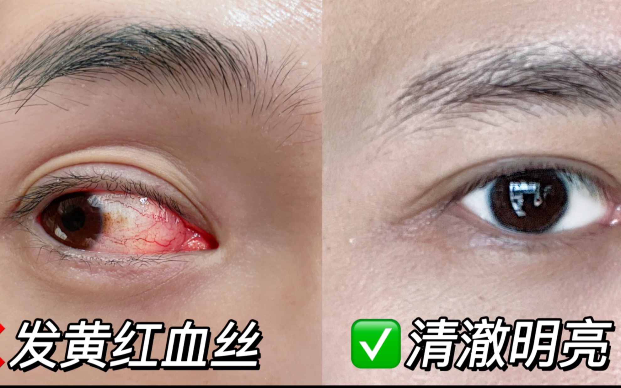 女港星眼白明亮?告别红血丝发黄干涩! 眼睛一天看手機電腦十小時!