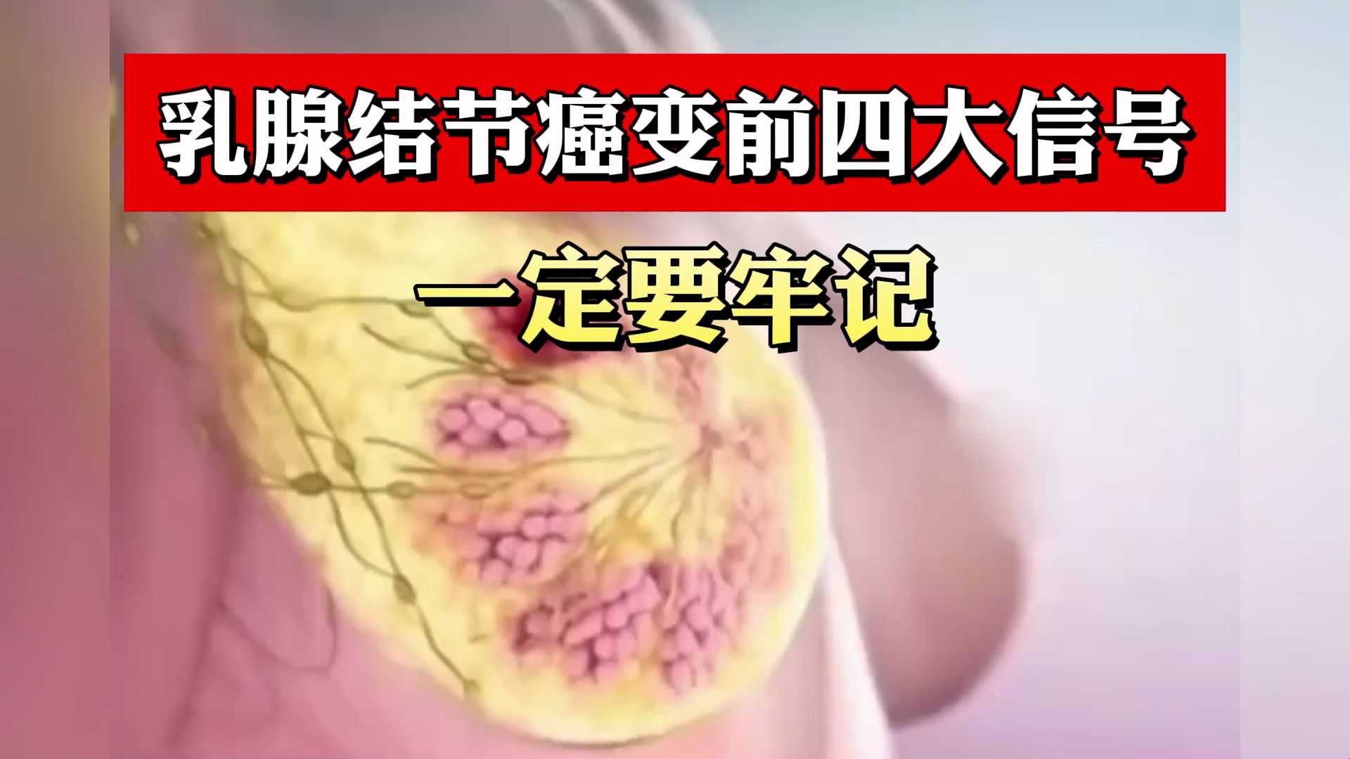 乳腺结节癌变前四大信号,一定要牢记