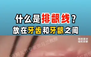 Скачать видео: 什么是排龈线？放在牙齿和牙龈之间，看完是不是瑟瑟发抖？