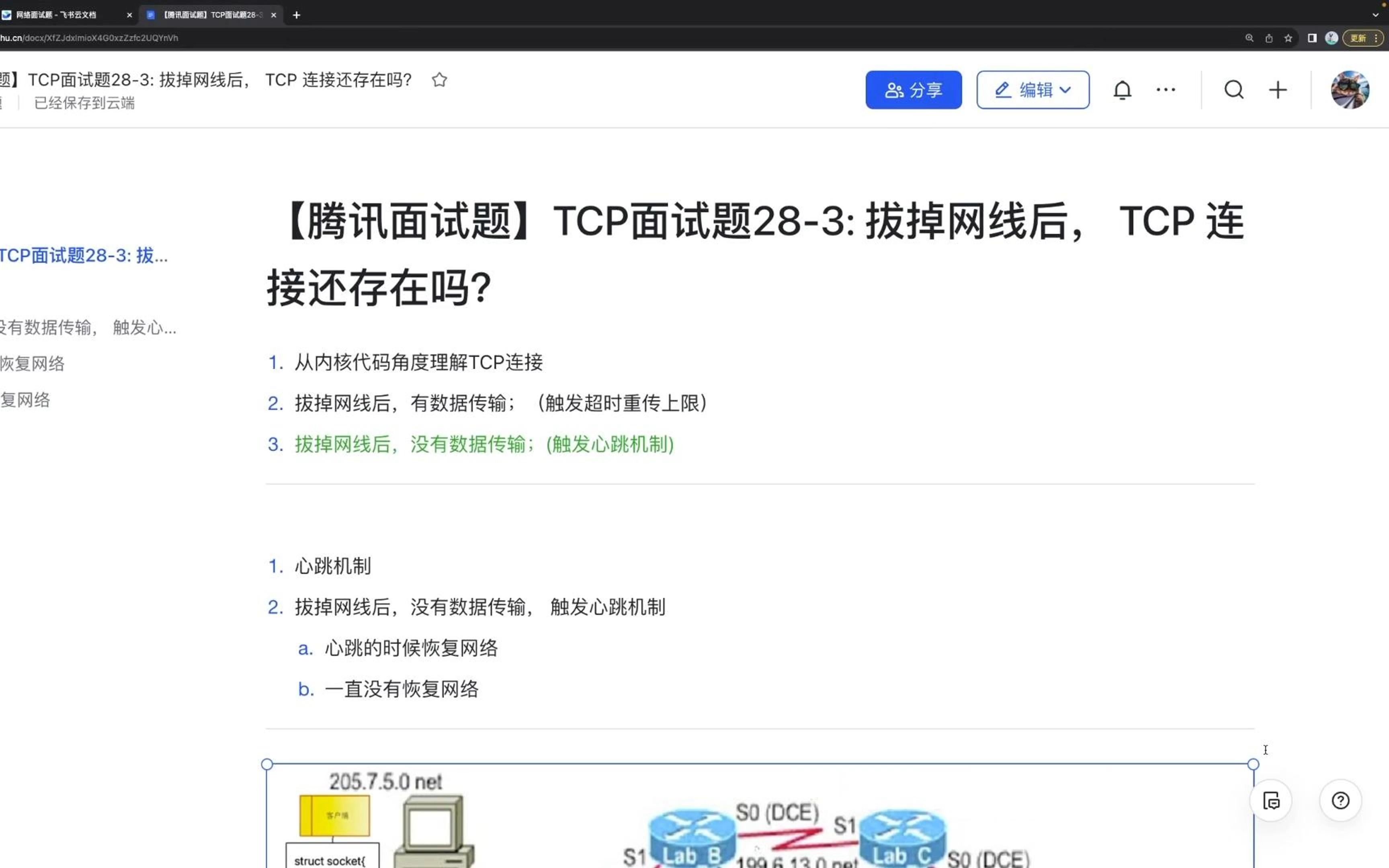 【腾讯面试题】TCP面试题283 拔掉网线后, TCP 连接还存在吗?哔哩哔哩bilibili