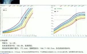 骨龄身高预测,请不要上传普通手掌图片,请上传手掌X光图片,医院胶片哔哩哔哩bilibili