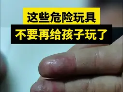 Tải video: 这些危险玩具不要再给孩子玩了