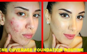 Acne Coverage Foundation Routine (PREACCUTANE) Drugstore Pr哔哩哔哩bilibili