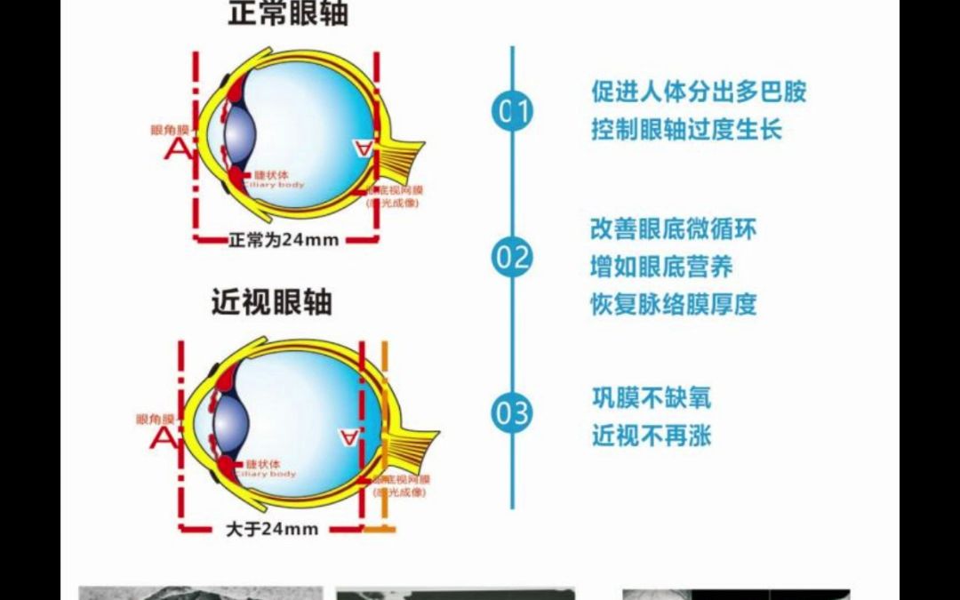 哺光仪租售电话173213O9288哺光仪租赁预防和治疗近视的设备哔哩哔哩bilibili