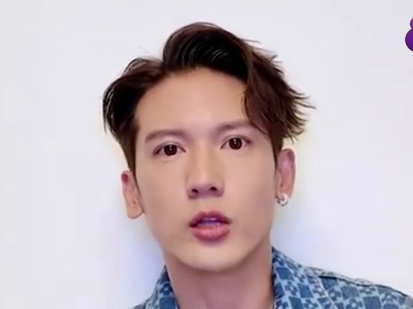 香港艺人关智斌自曝家中燃气泄漏导致面部二级烧伤