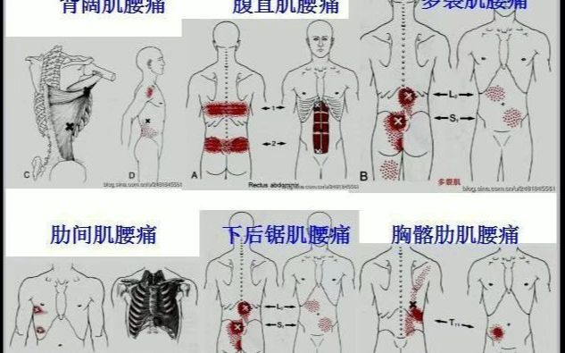 【纯干货】全身激痛点手册图文并茂非常全面哔哩哔哩bilibili