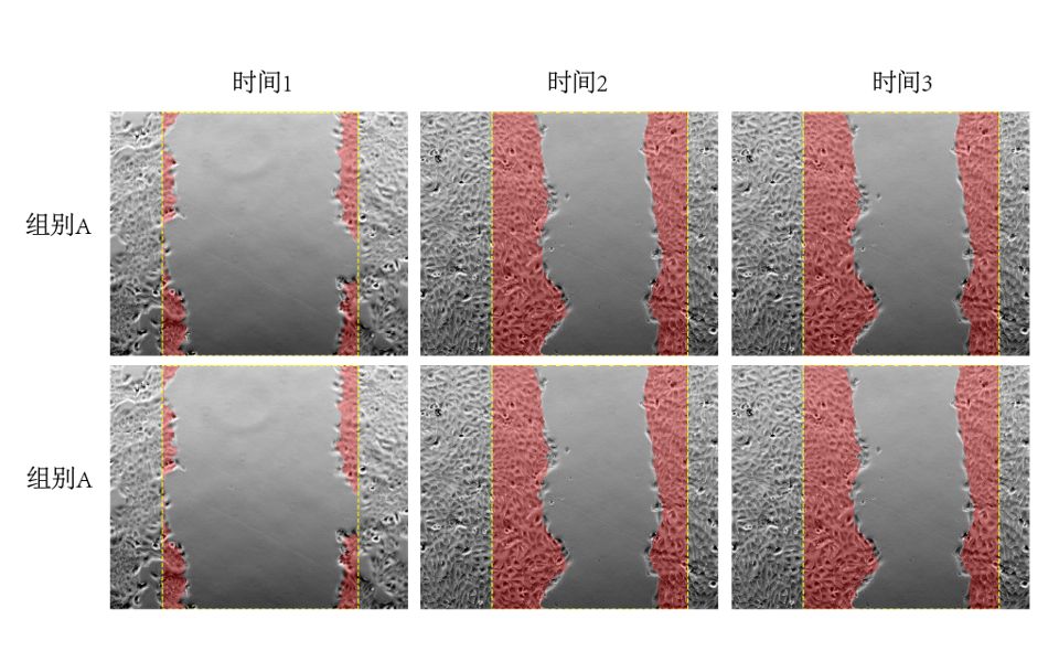 [图]细胞划痕实验的图片处理与面积计算（详细版）