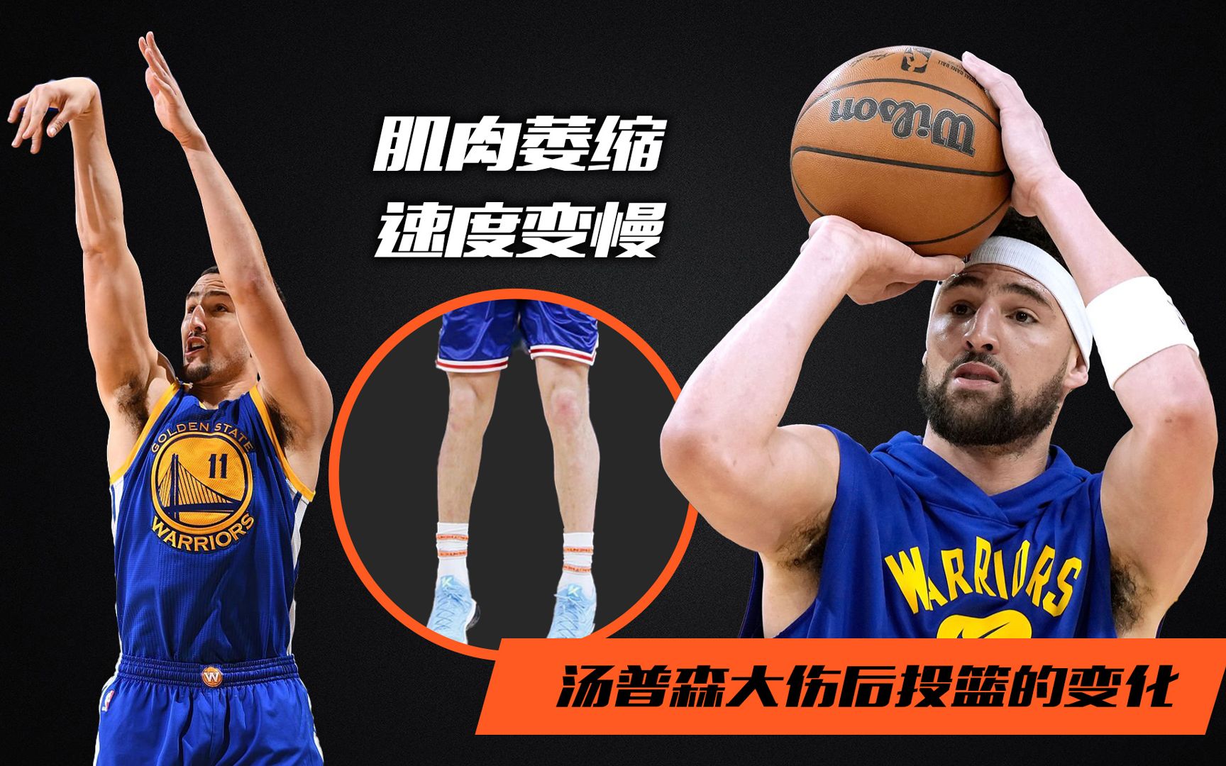 肌肉萎缩,速度变慢!解析汤普森两次重伤后投篮的变化