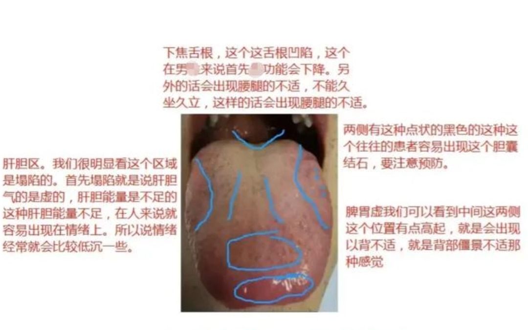 [图]舌象知健康，认真学