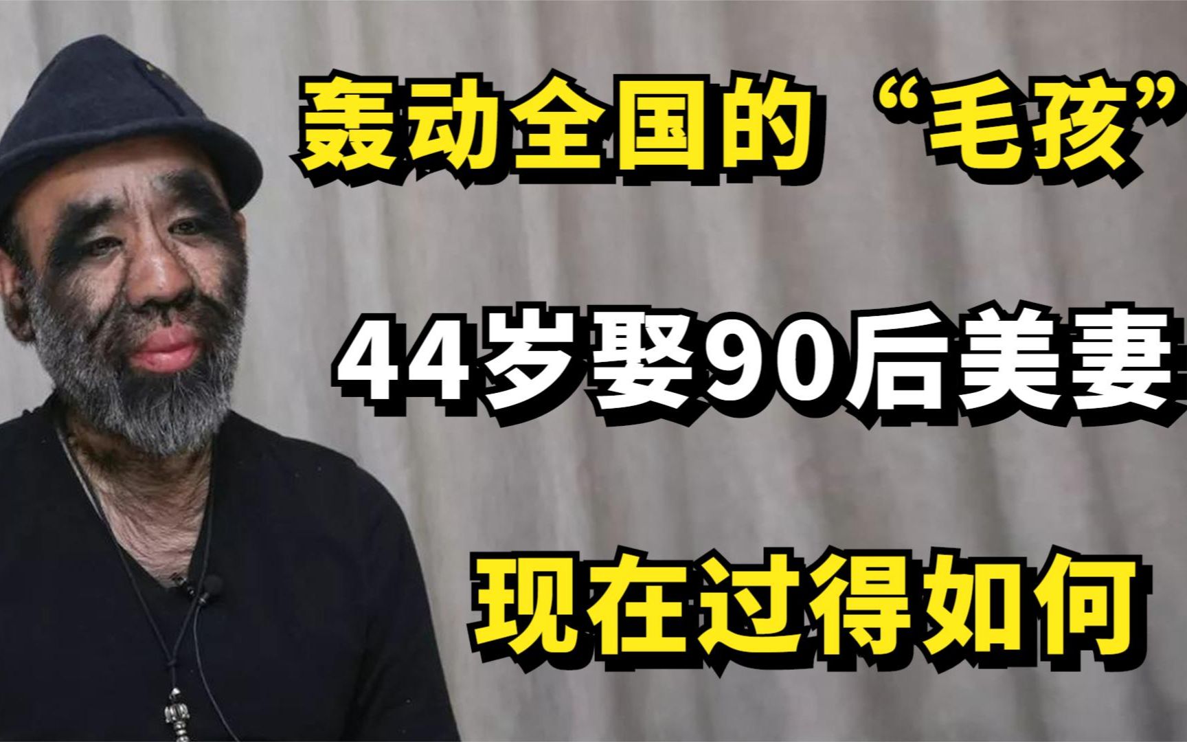 44年前,曾轰动全国的“毛孩”于震寰,他现在过得如何?哔哩哔哩bilibili