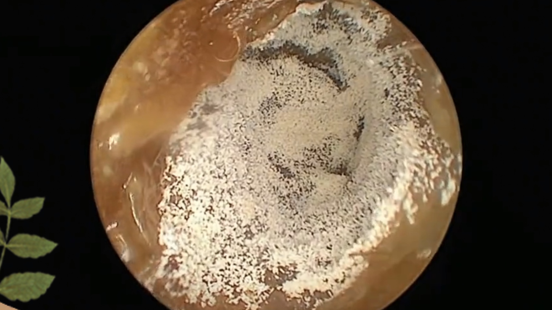 耳朵里密密麻麻 长了好多蘑菇