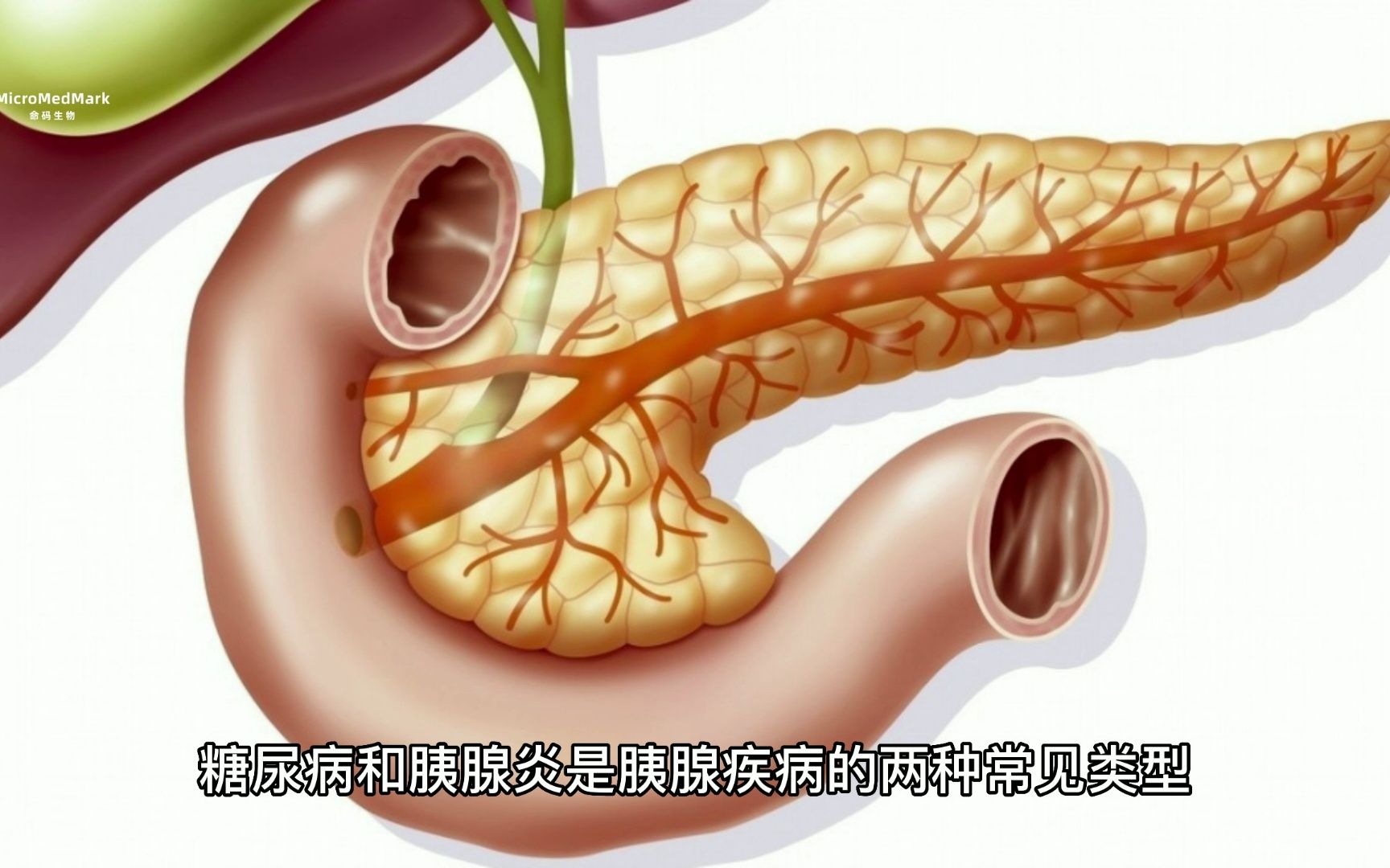 如何通過飲食控制糖尿病和胰腺炎