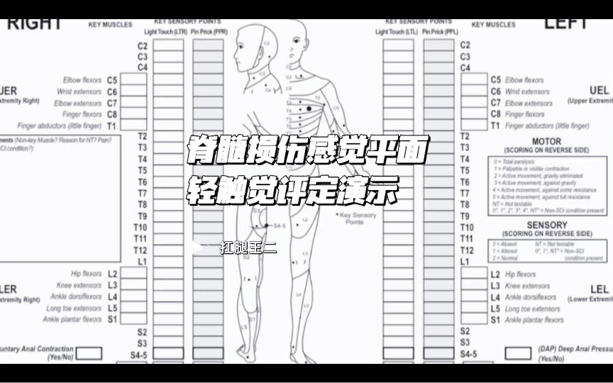 [图]脊髓损伤感觉平面轻触觉评定演示