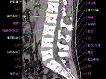 [图]腰椎矢状位逐层解剖#断层影像