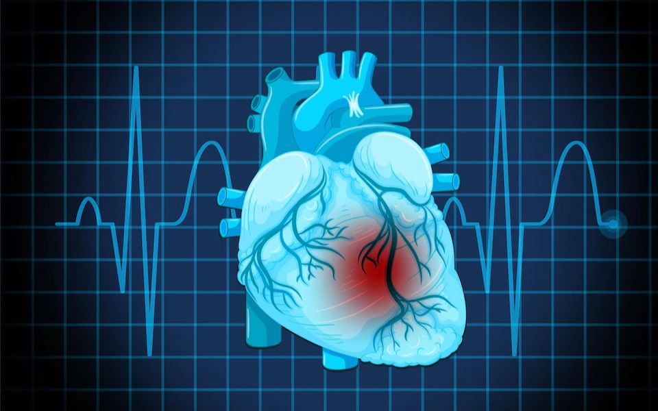 【自用】网课录屏 | 诊断-心电图1-1