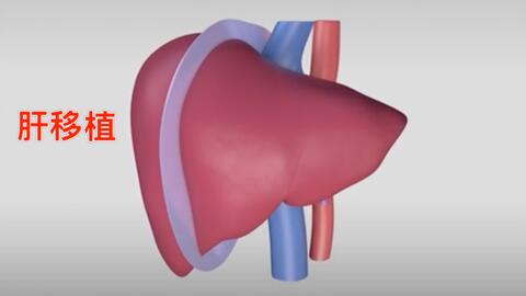 肝移植手术操作详解 Liver Transplant Living Donor Right Hepatectomy Donor Procedure 哔哩哔哩 Bilibili