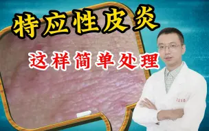 Descargar video: 特应性皮炎 这样简单处理