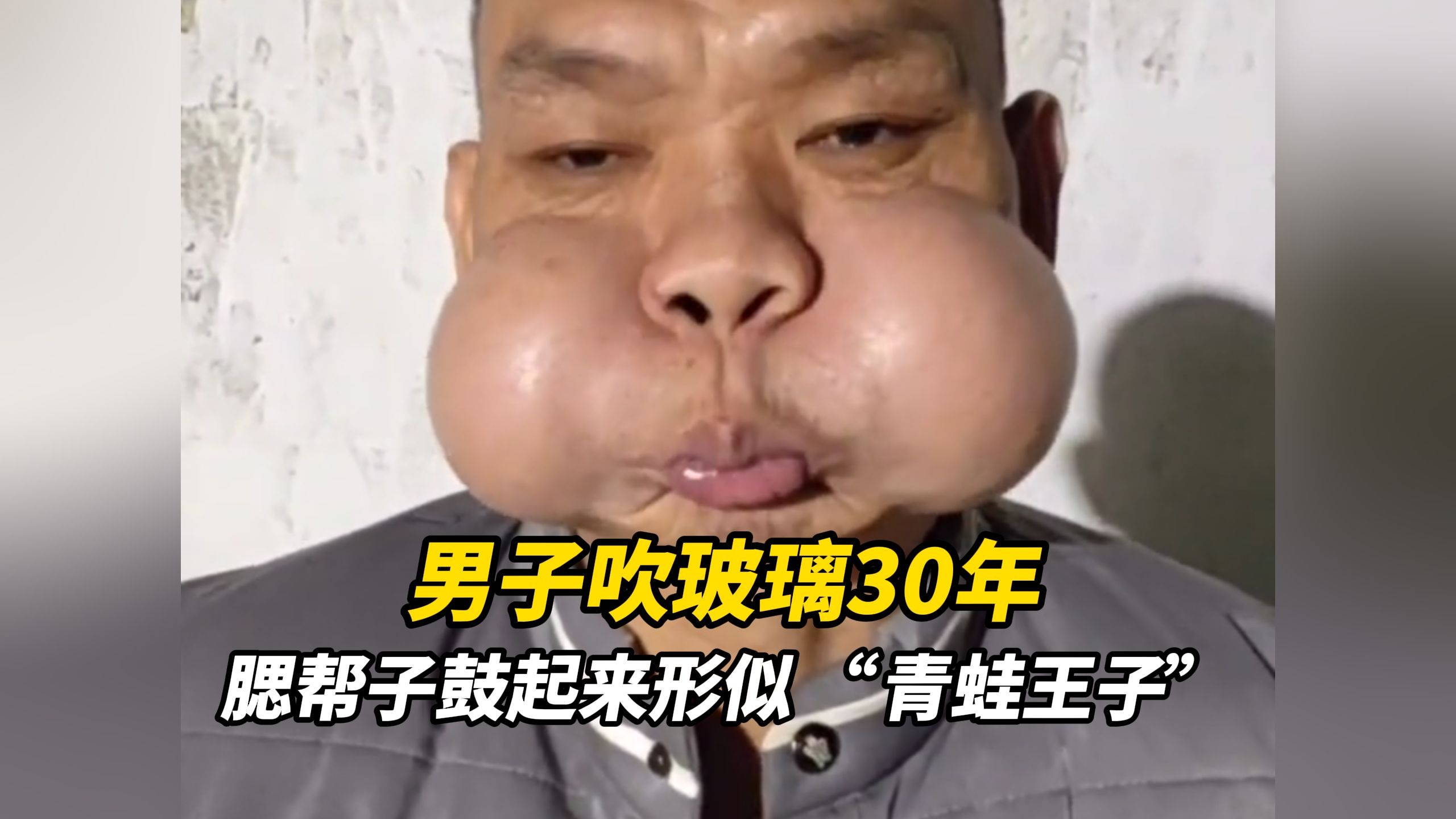 男子吹玻璃30年，腮帮子鼓起来形似 “青蛙王子”，调侃自己会 “蛤蟆功”