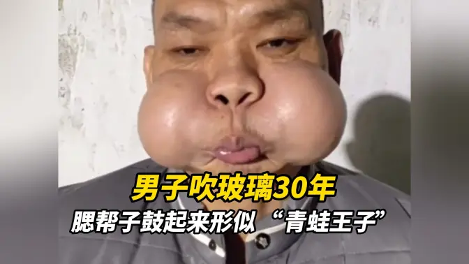 男子吹玻璃30年，腮帮子鼓起来形似 “青蛙王子”，调侃自己会 “蛤蟆功”