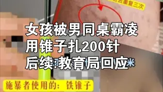 Скачать видео: 济南一女孩被同学扎200针后续:教育局回应