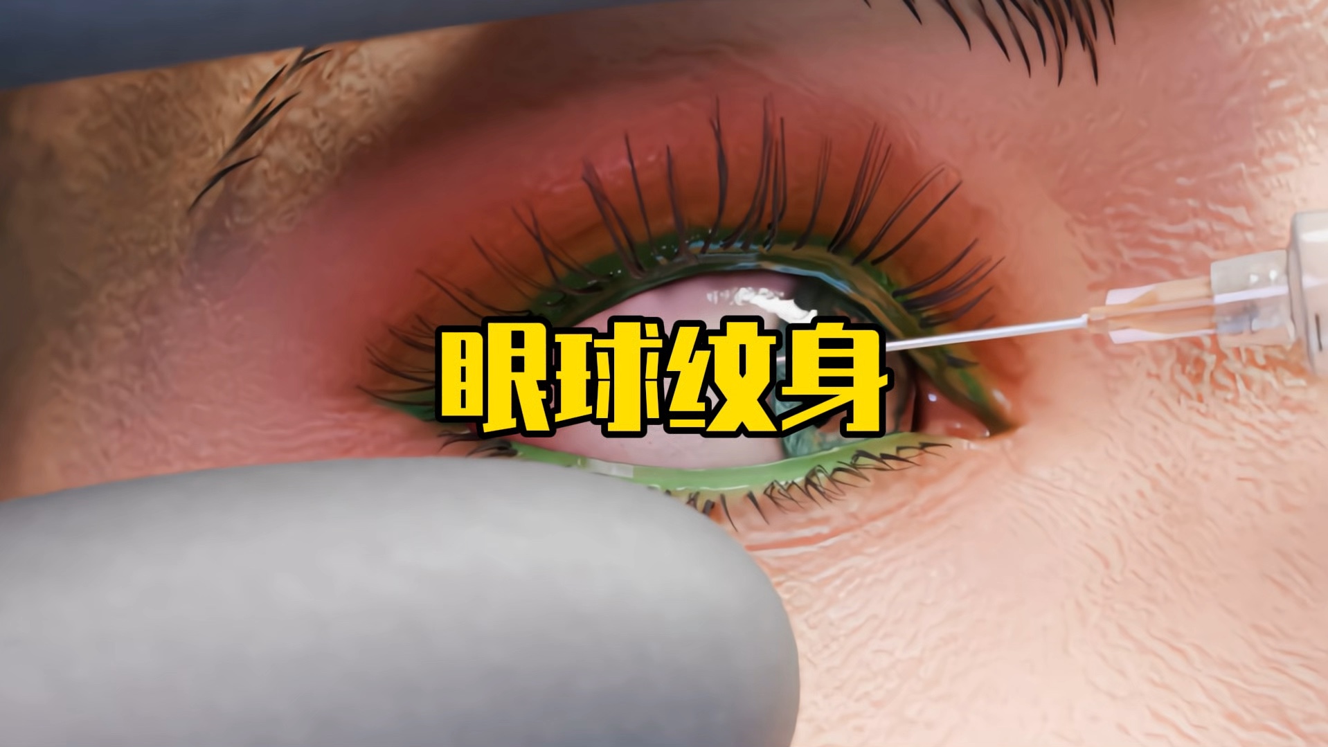 眼球上是怎么纹身的?