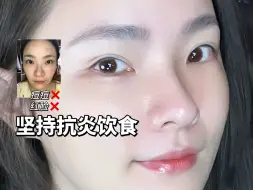 Download Video: 3年抗炎饮食 皮肤真的变好了！痘痘红脸没啦