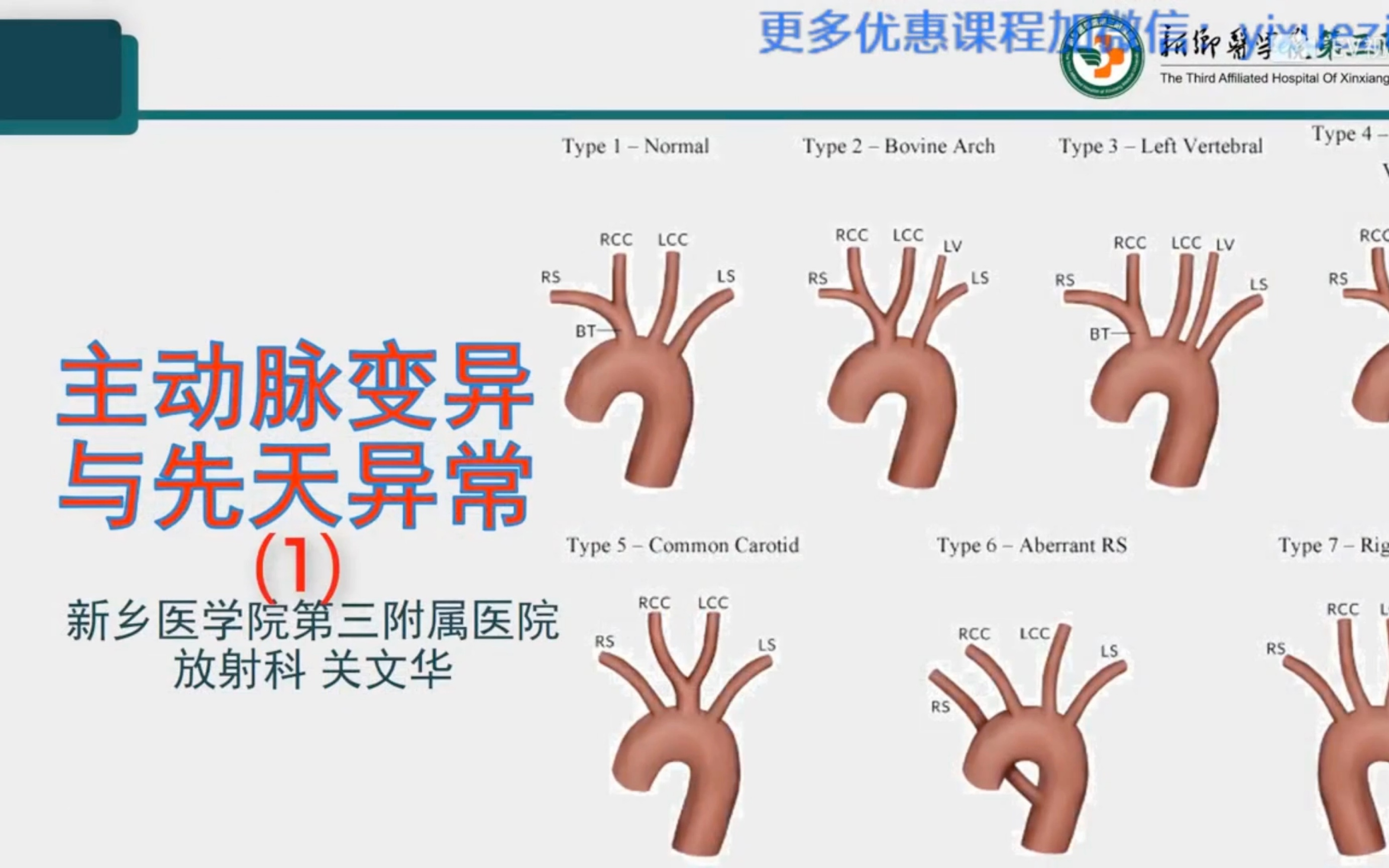 主动脉弓三个分支图解图片