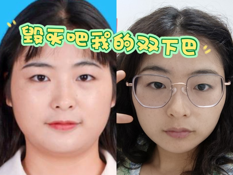 双下巴好像在逐渐消失了呢!