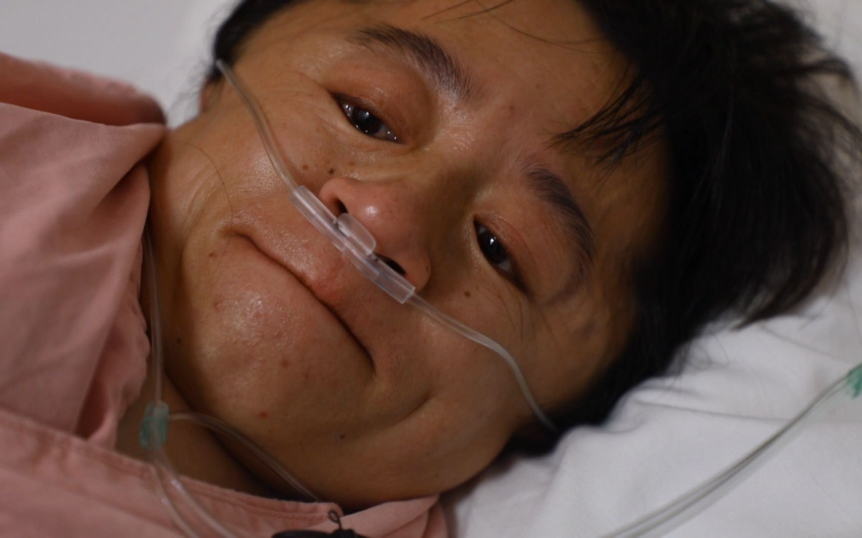 85厘米"脆骨病"妈妈艰难保胎,虽小心翼翼,却还是在34周体检时发现问题