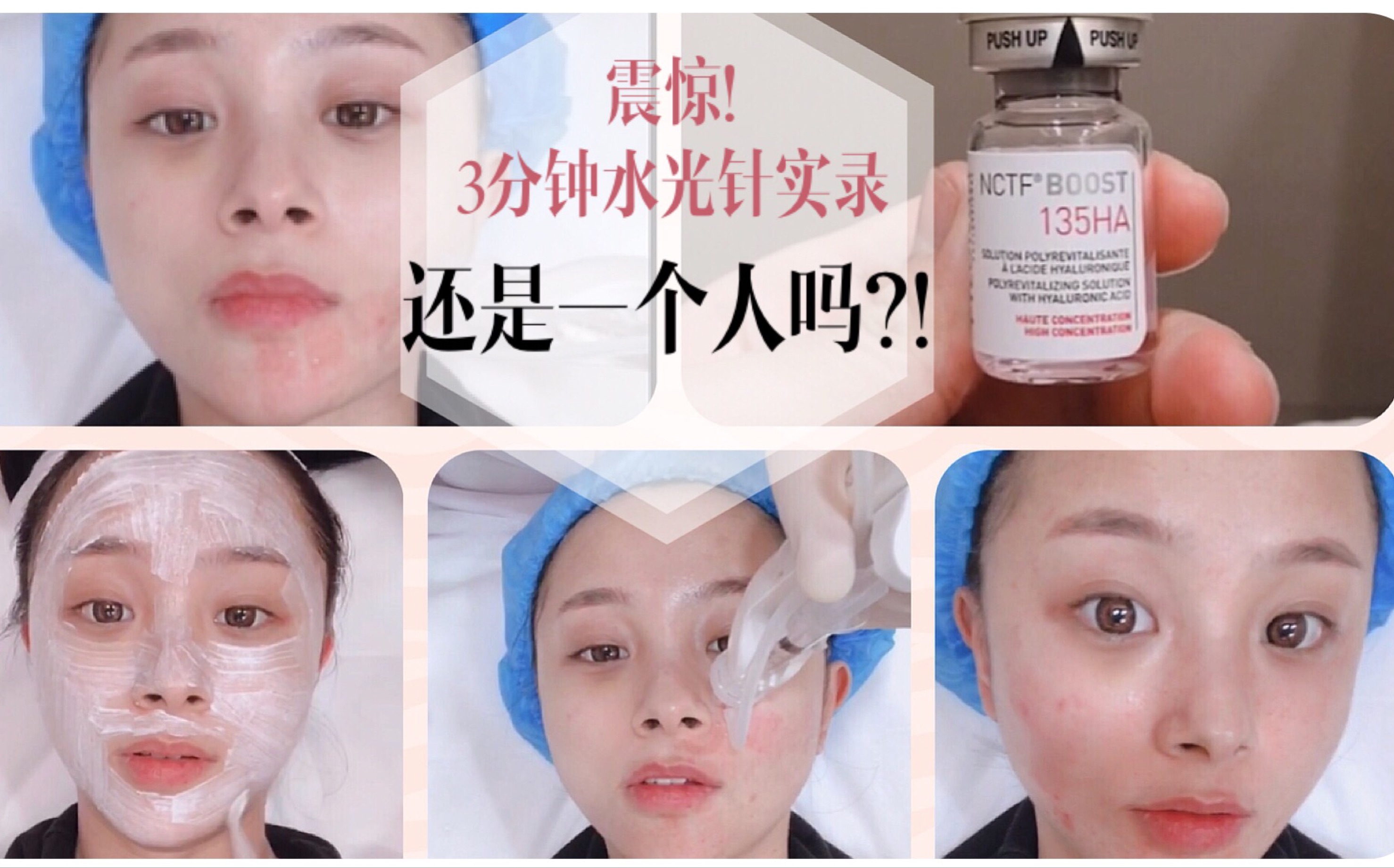 震惊3分钟水光针实录女孩前后还是一个人吗