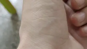 各位帮我看看，从小到大，脉跳一直很明显，性别男