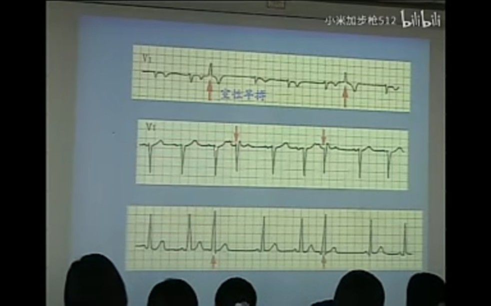 复旦大学心电图经典哔哩哔哩bilibili