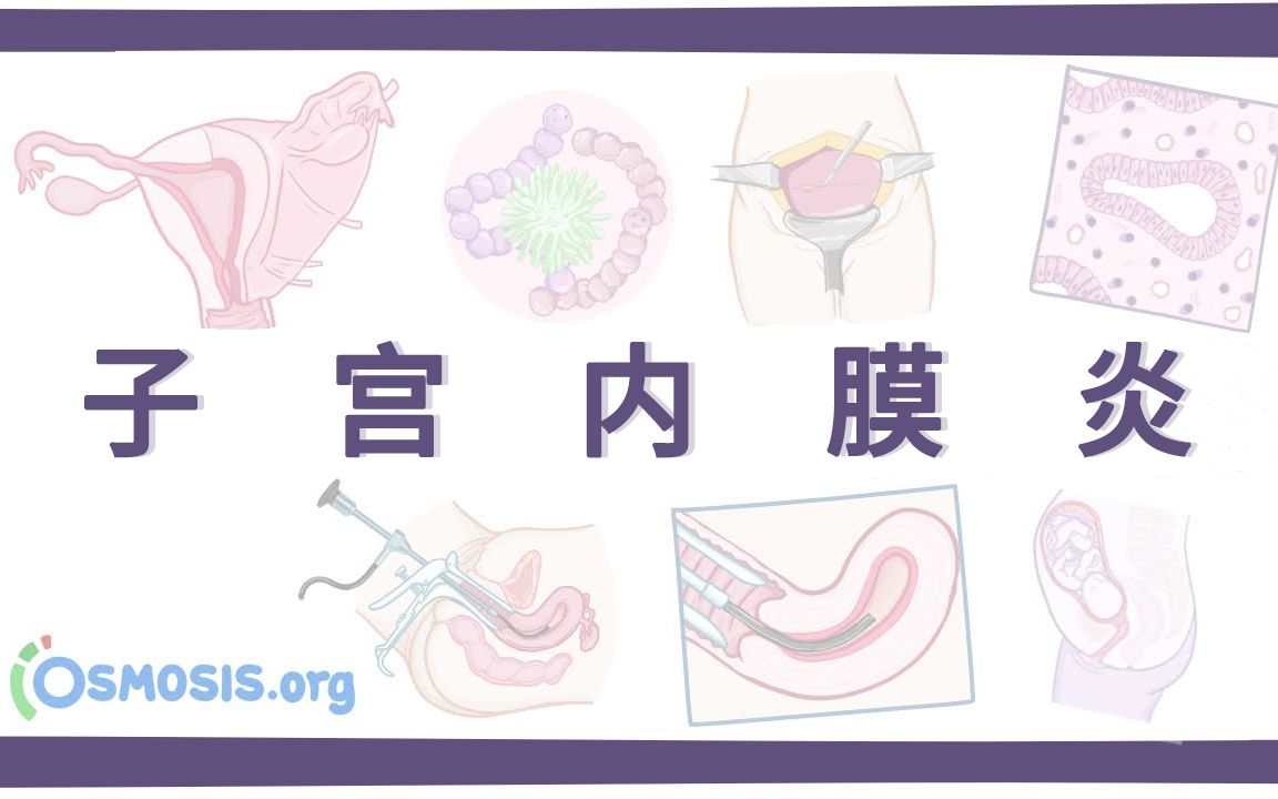 【Osmosis】子宫内膜炎 Endometritis(中英字幕)哔哩哔哩bilibili