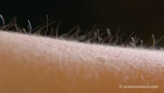 【近距离观察汗毛竖起】在我们皮肤中，有一种肌肉叫做立毛肌，当立毛肌收缩时，我们的汗毛就会竖起，立毛肌舒张时，汗毛会恢复一般状态。