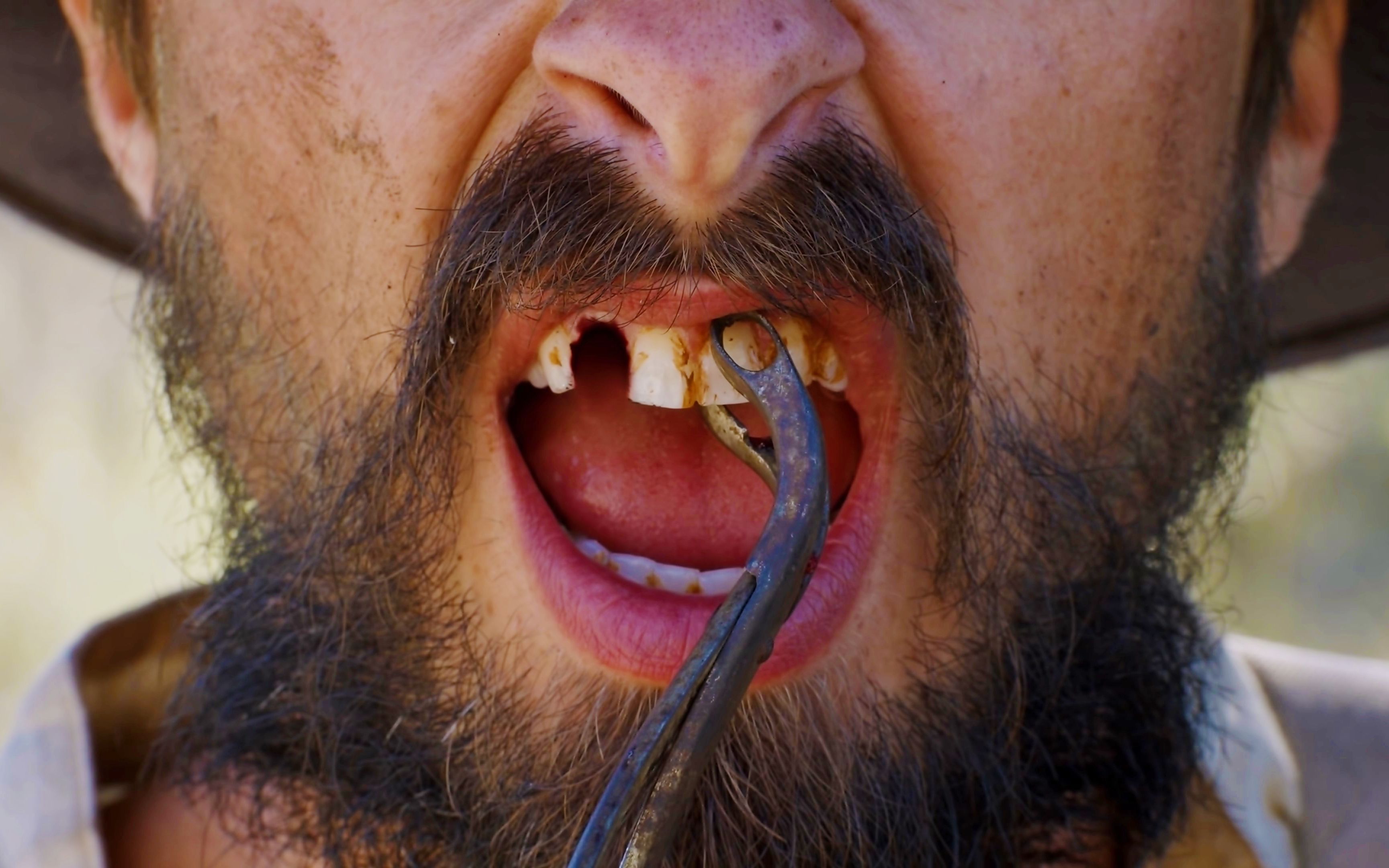 恐怖短片点齿成金拔掉的牙齿能变黄金