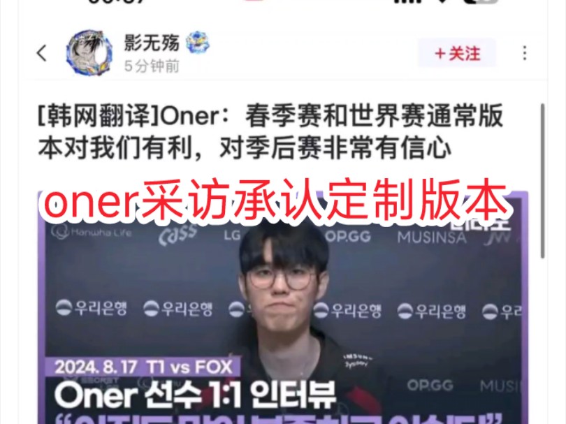 oner采访承认定制版本,太实在了!