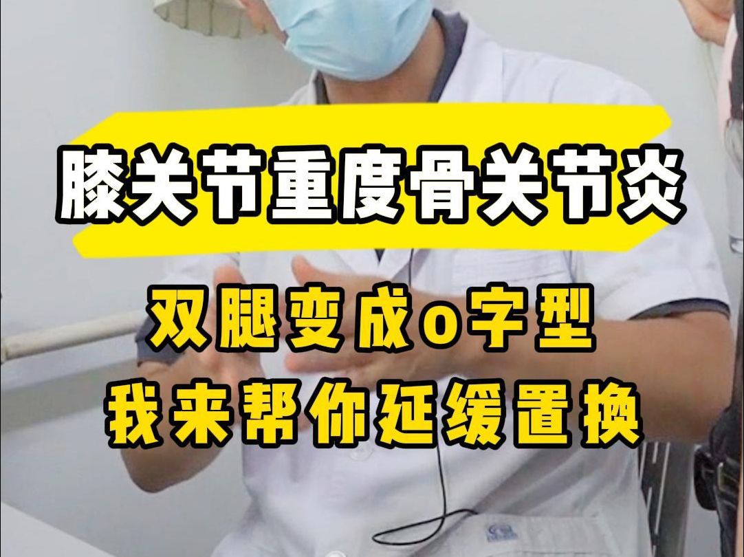 双腿变形成o字样,必须置换吗?一个方法帮你延长膝关节寿命