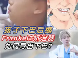 Download Video: 义乌正畸丨小朋友下巴后缩，frankel2如何导出下巴？