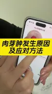 Download Video: 肉芽肿发生原因及应对方法