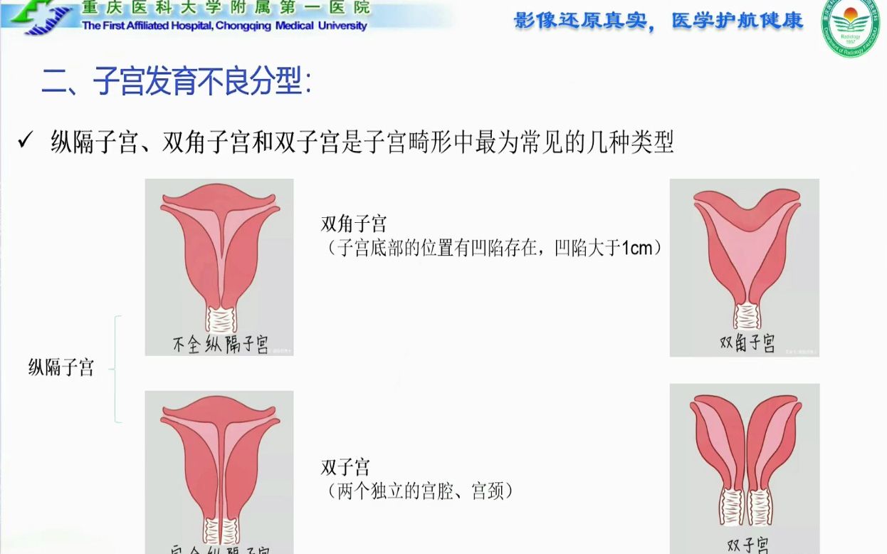 12.子宫3D图像后处理技术规范及临床应用CT、MRI图像后处理系列1哔哩哔哩bilibili