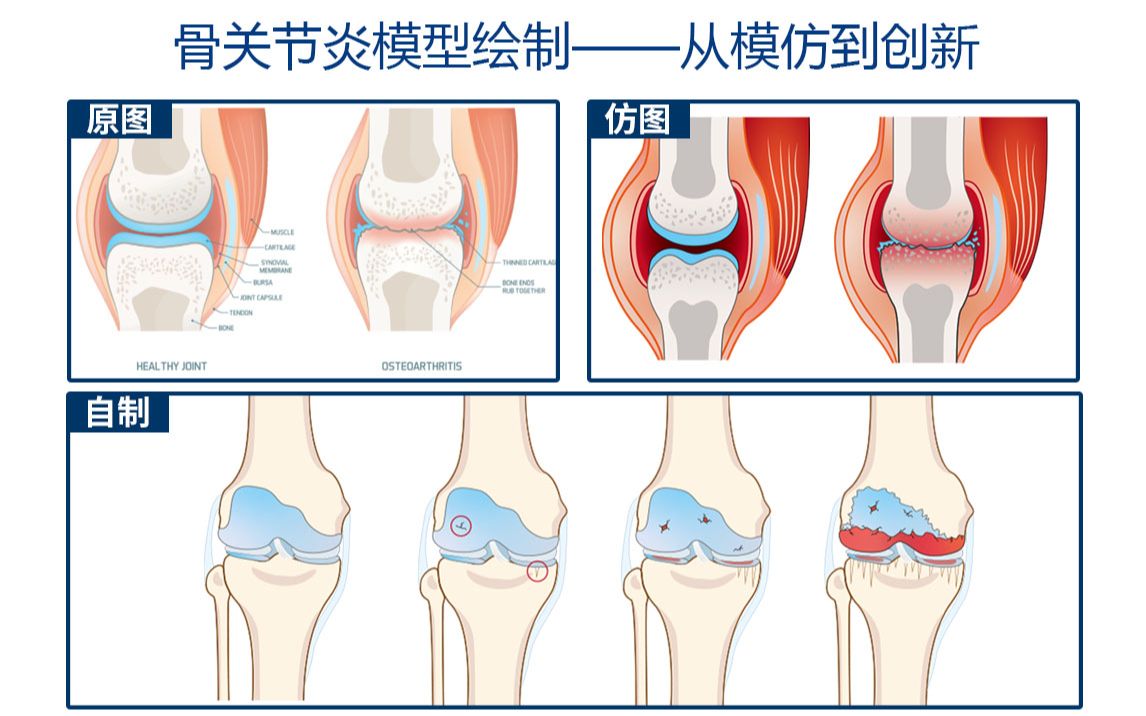 【科研绘图】骨关节炎模型绘制:我是如何实现仿图绘制然后形成自己风格的示意图哔哩哔哩bilibili