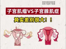 子宫肌瘤VS子宫腺肌症